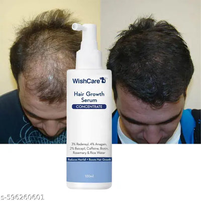 WishCare Hair Growth Serum Concentrate - 3% Redensyl, 4% Anagain, 2% Baicapil, Caffeine, Biotin & Rice Water - Advanced Hair Growth Serum for Hair Fall Control 100ml